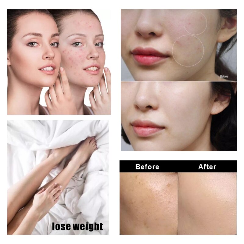 Customized Infrared Beauty Device Manufacturer - 660/850Nm Relieve Fatigue Pain Red Light Therapy Tool