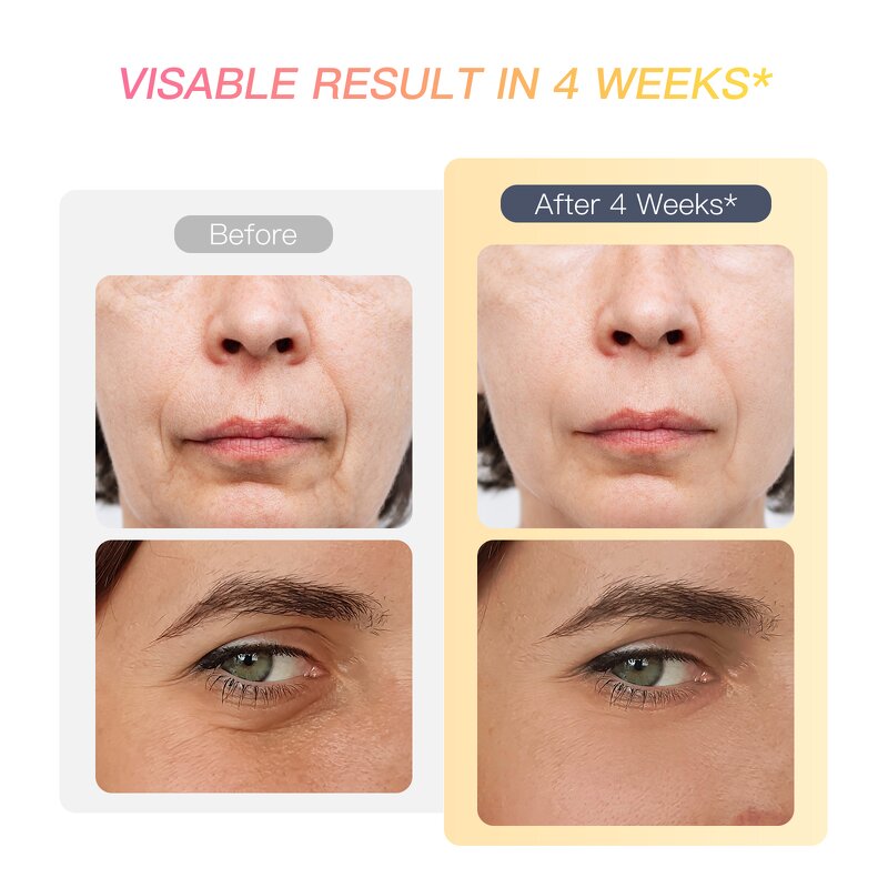 Face Lifting Device Manufacturer - Custom 3 Gears EMS Microcurrent for Home