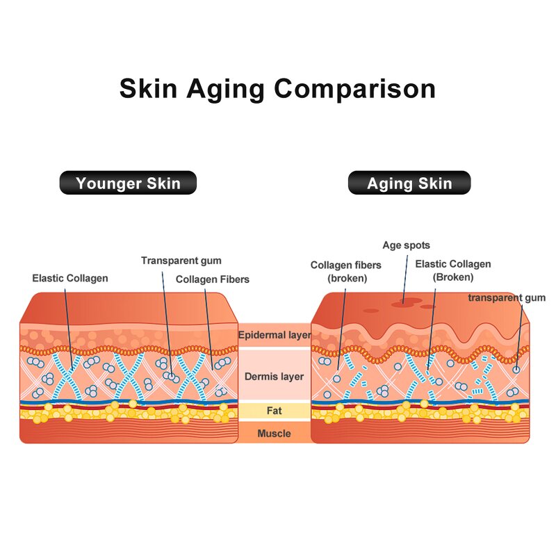 RF Beauty Device Manufacturer - Eye Face Lift Skin Tightening for Home