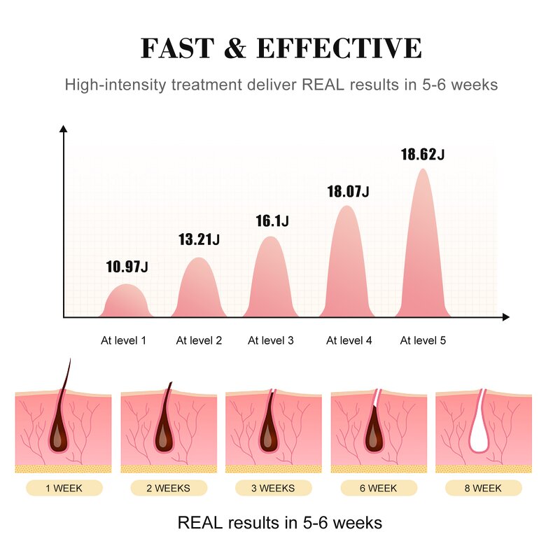IPL Hair Removal Device Manufacturer - Portable Ice for Women