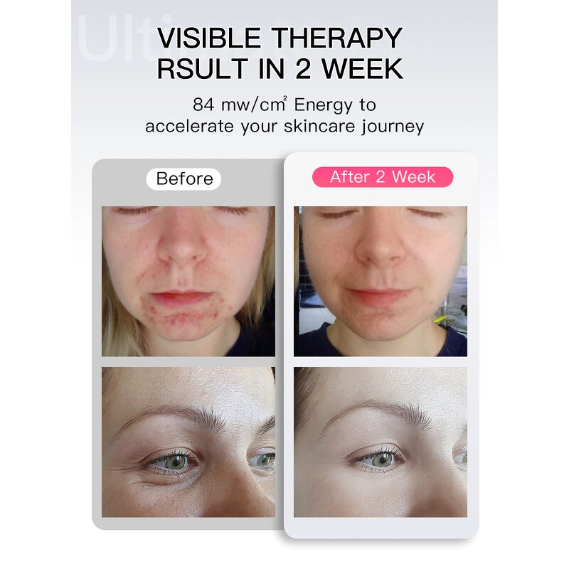 LED Face Neck Mask Manufacturer - Infrared Red Light Therapy for Collagen