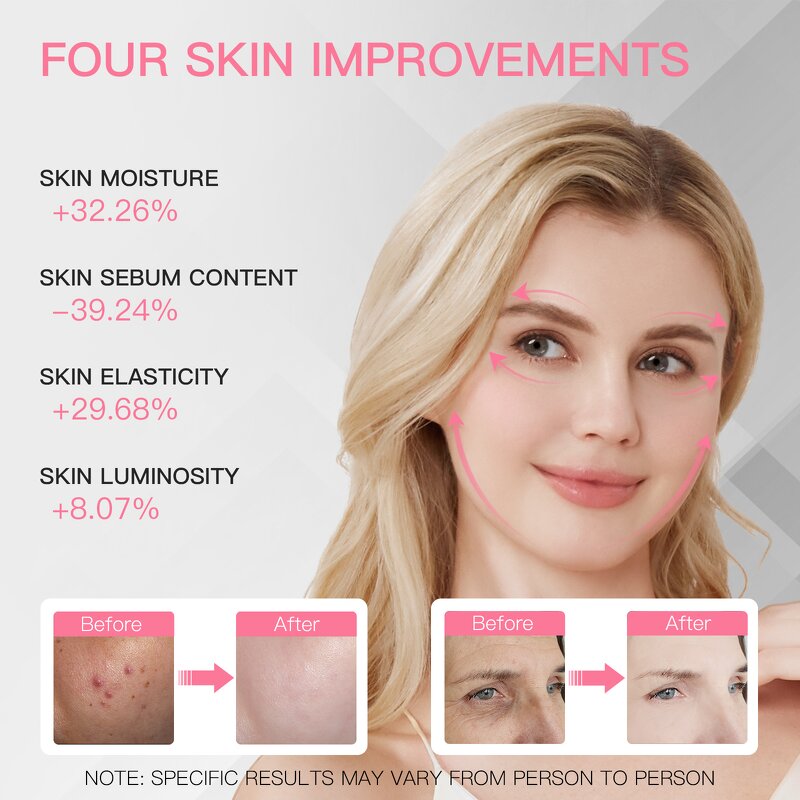 LED Face Mask Manufacturer - Near Infrared 4 Colors 630nm 850nm