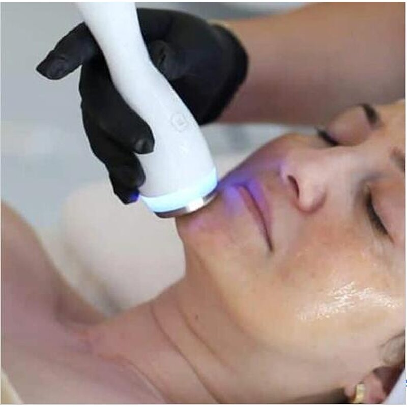 2 En 1 RF Lifting Machine - Cooling Heating Cryo Facial Electroporation Red Light