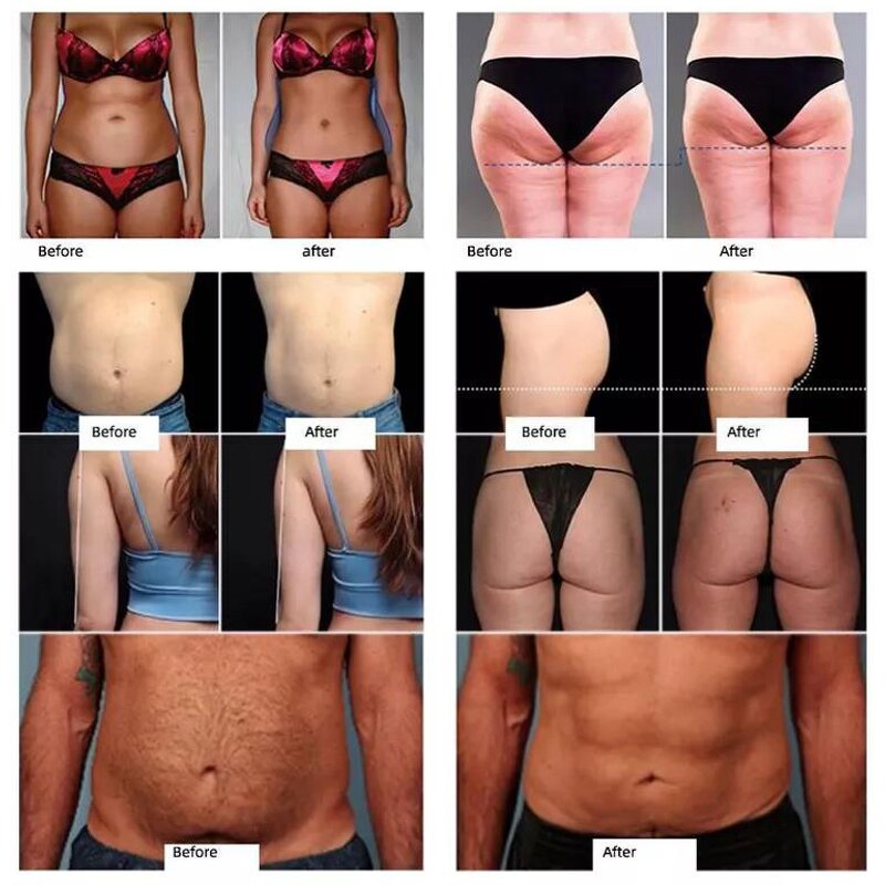 EMS Muscle Stimulator - 15 Tesla 2 Handles Portable Body Sculpting Machine