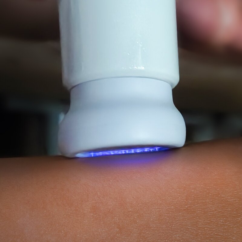 Plasma Device Consumables Tips - Jet Cool for Hair Care & Clearer Skin