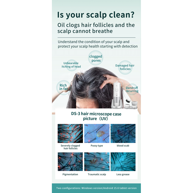 AI Intelligent Hair Analyzer - Multilingual Hair Scalp Analysis Machine With 4 Lens