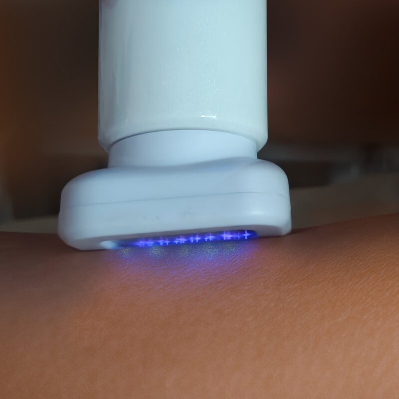 Plasma Device Consumables Tips - Jet Cool for Hair Care & Clearer Skin