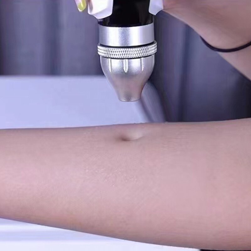 Jet Peel Facial Machine - 2025 High Pressure Non-Invasive Anti-Wrinkle Mesotherapy