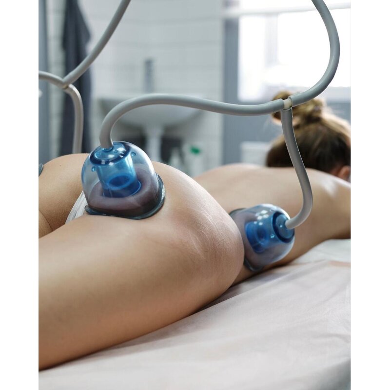 Non-Surgical Buttock Machine - Butt Lifting Vacuum Breast Enlargement Device