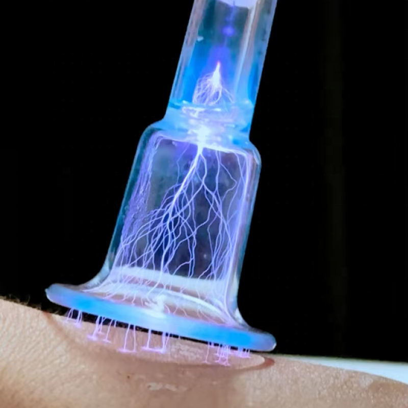 8 in 1 Cold/Hot Plasma Pen - Ozone Face Lifting Acne Treatment Device