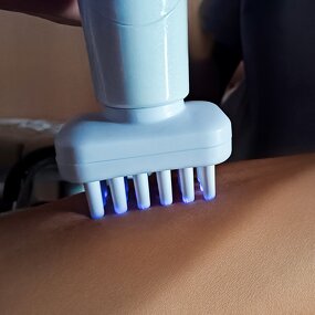 Plasma Device Consumables Tips - Jet Cool for Hair Care & Clearer Skin