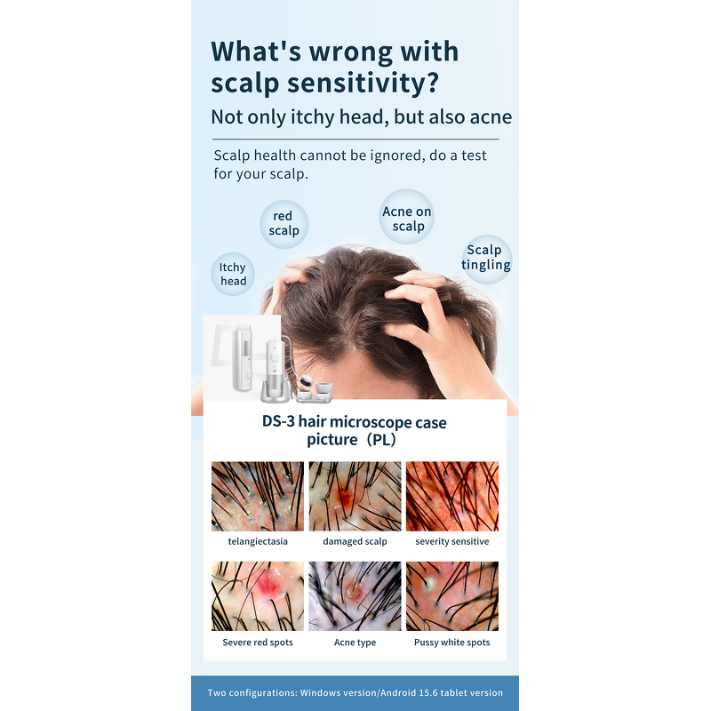 AI Intelligent Hair Analyzer - Multilingual Hair Scalp Analysis Machine With 4 Lens