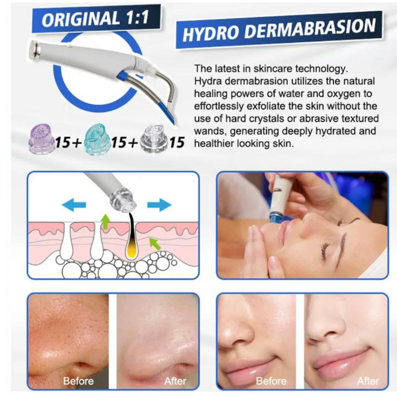 Hydro Facial Aqua Clean Machine - Professional Blackhead Removal Nutrient Absorption