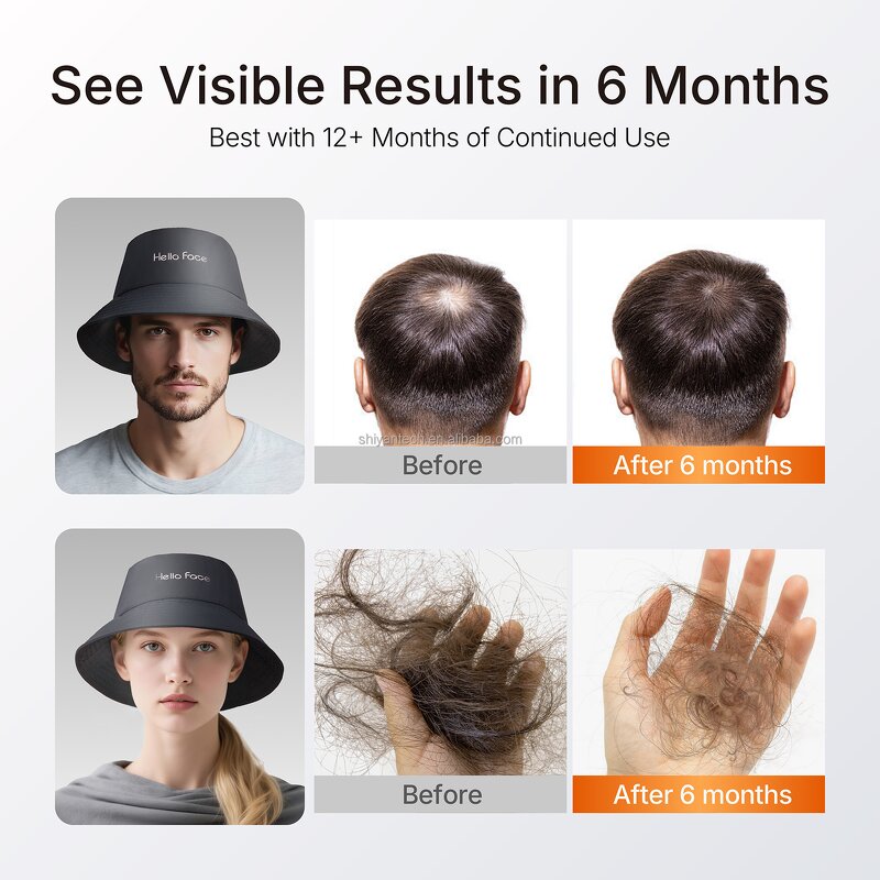 LED Hair Regrowth Cap - Red Light Anti Hair Loss Alopecia Baldness Treatment