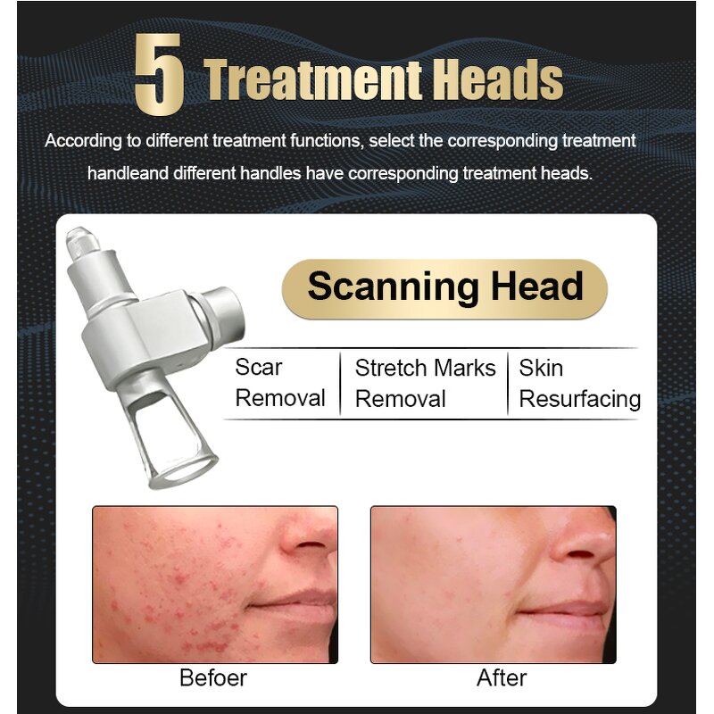 Portable CO2 Fractional Machine - Skin Rejuvenation Scar Freckle Removal Device