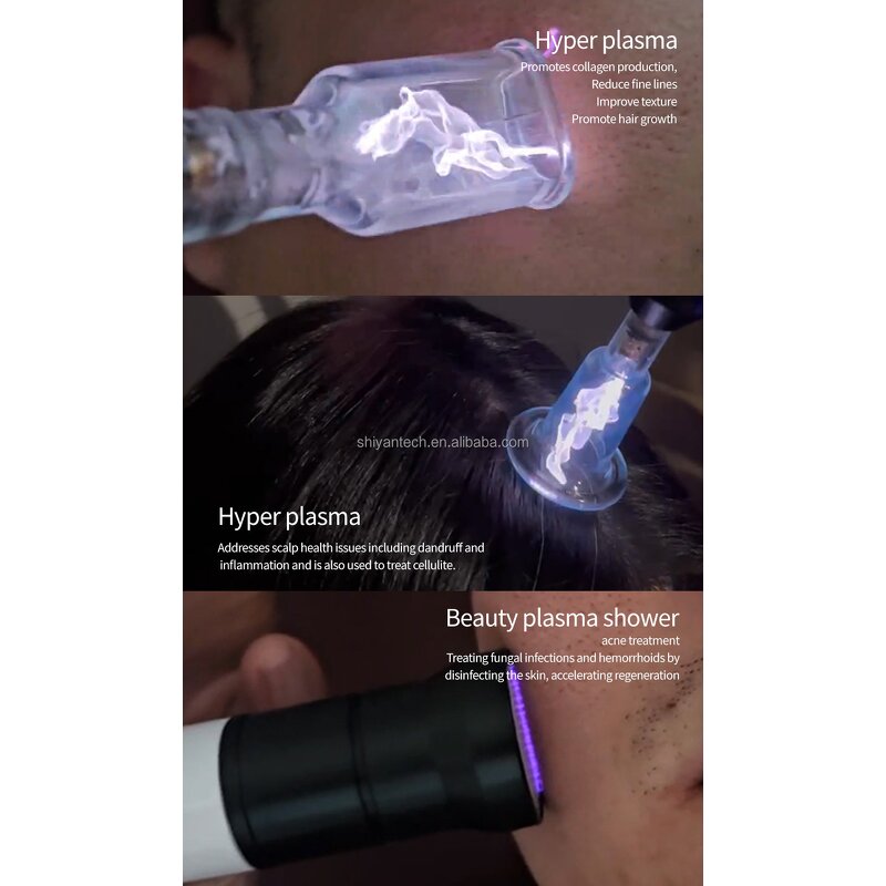 8 in 1 Cold/Hot Plasma Pen - Ozone Face Lifting Acne Treatment Device