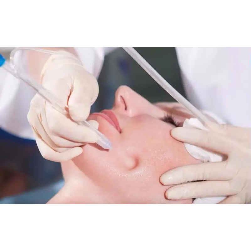 Oxygen Water Jet Peel Sprayer - High-pressure Deep Cleansing Skin Rejuvenation