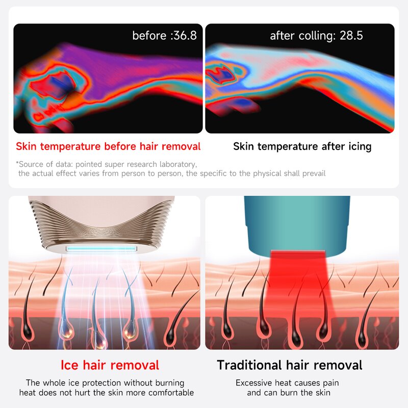 IPL Hair Removal Device Manufacturer - Permanent Painless Professional Freezing Spring