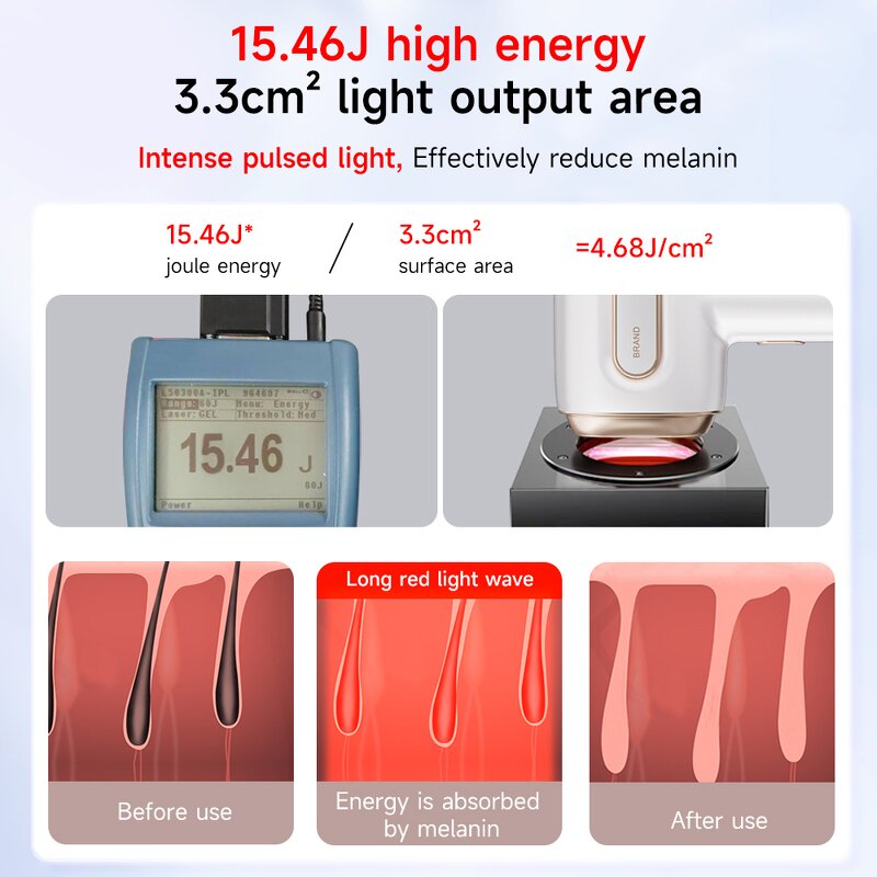 IPL Hair Removal Machine Manufacturer - ICE Freezing Permanent for Home Use