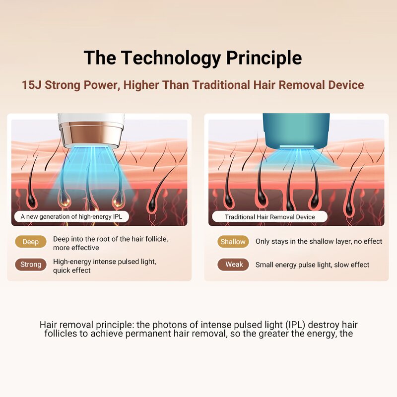 IPL Hair Removal Device Manufacturer - Multifunctional Unlimited Flashes Ice Cooling