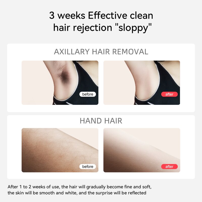 IPL Hair Removal Epilator Manufacturer - Sapphire Waterproof Freezing Point Mini