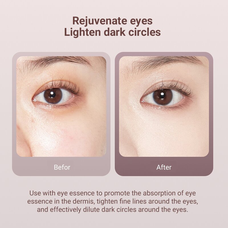 Eye Massage Instrument Manufacturer - Galvanic Anti-aging Wrinkle Removal & Lifting