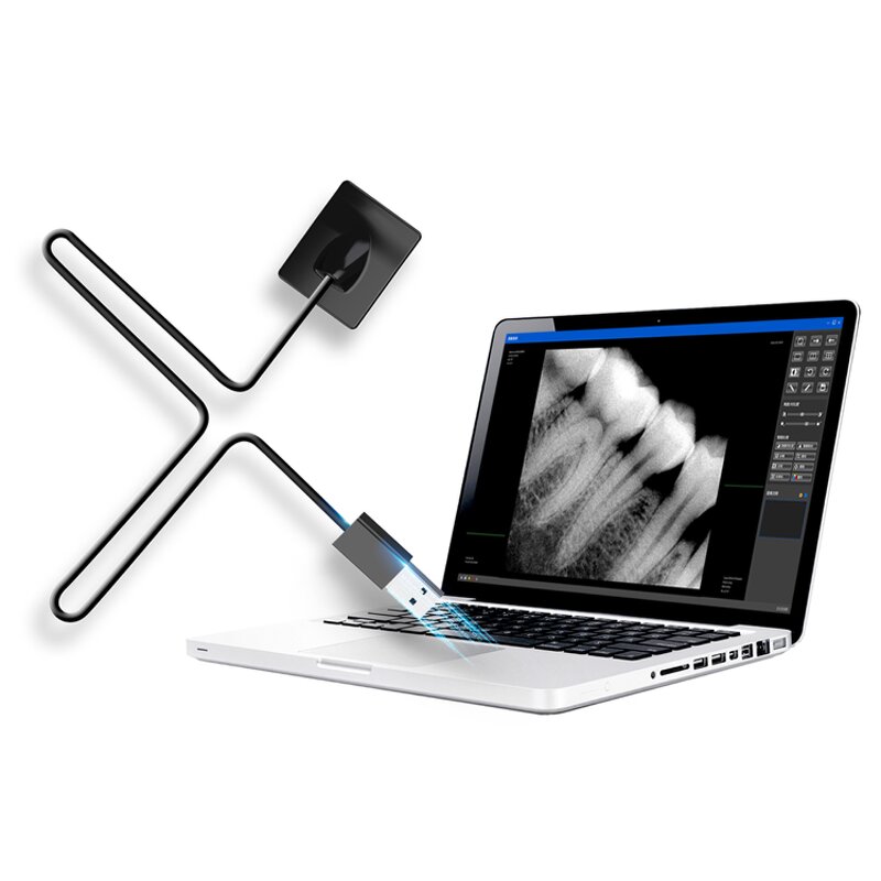 Dental Radiography Sensor - Manufacturer Price Clear Intraoral Imaging Clinic