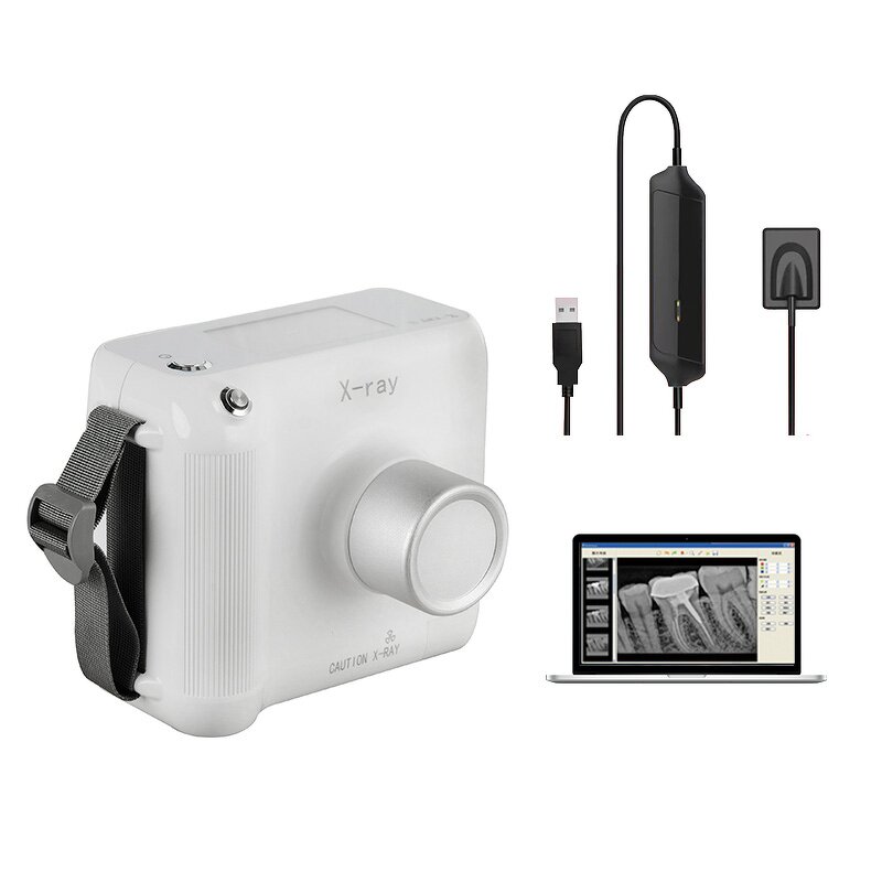 Portable Dental X Ray Machine - Rayos X Clinic Dentist Xray Sensor Unit