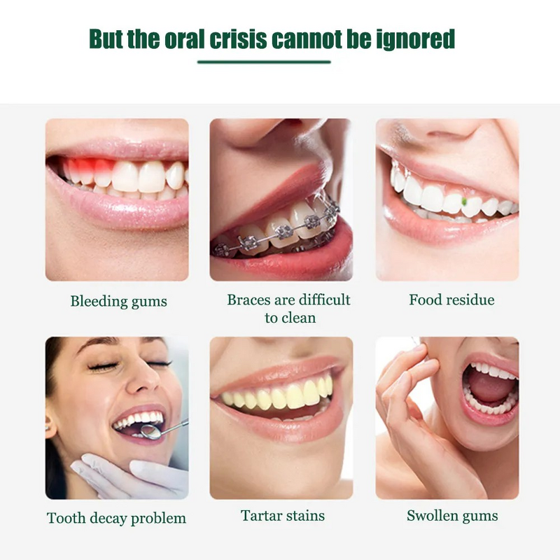 Cordless Water Flosser - Travel Portable Kids Large Tank Jet Dental Irrigator