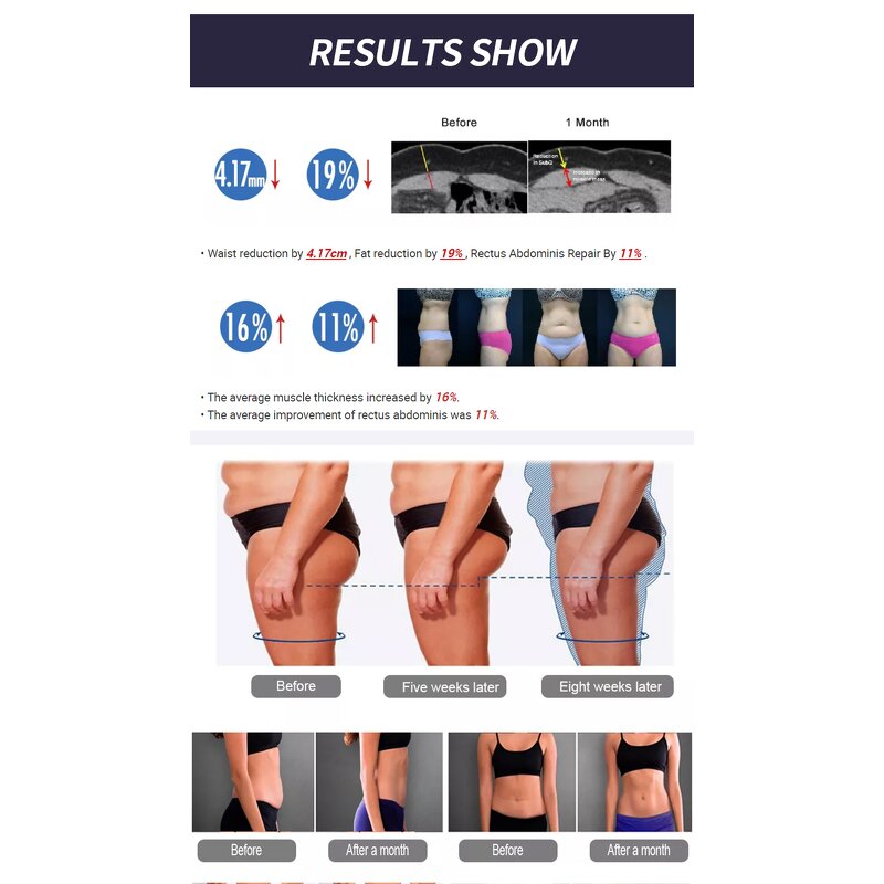 EMS Muscle Stimulator - Professional 4 Handles Emszero Rf Tesla Emsculping Neo