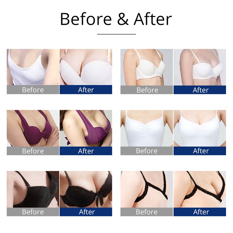 BBL Vacuum Breast Machine - Therapy Cupping Bra Enhancement With 24 Cups