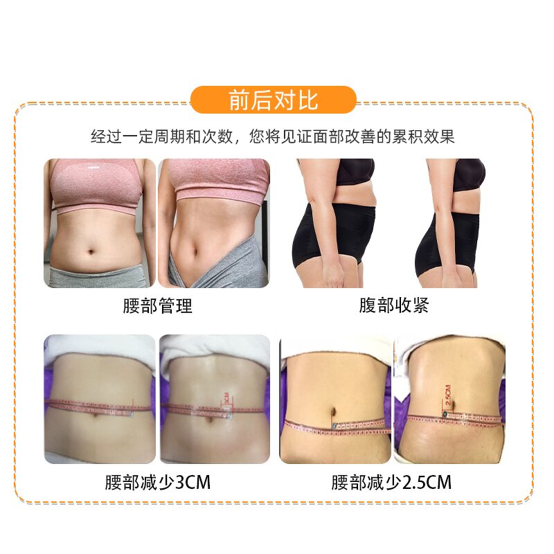 Home Skin Tightening Device - Face Body Wrinkle Neck Line Removal SMAS Lifting Tool