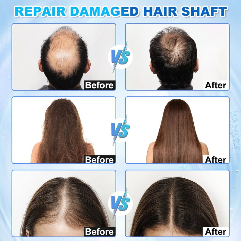 Desktop AI Scalp Analyzer - Mirror Device 5 In 1 Hair Loss Treatment Spa Detector