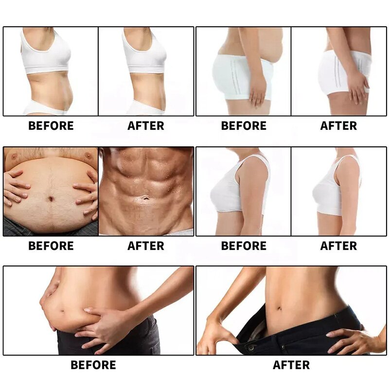 EMS Muscle Stimulator - Professional Emszero Fat Burning Slimming Weight Loss Tool