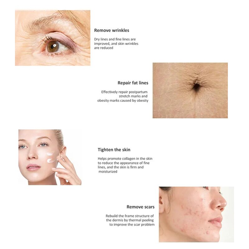 4D Co2 Laser Machine - Skin Resurfacing Scar Acne Tattoo Removal Beauty Device