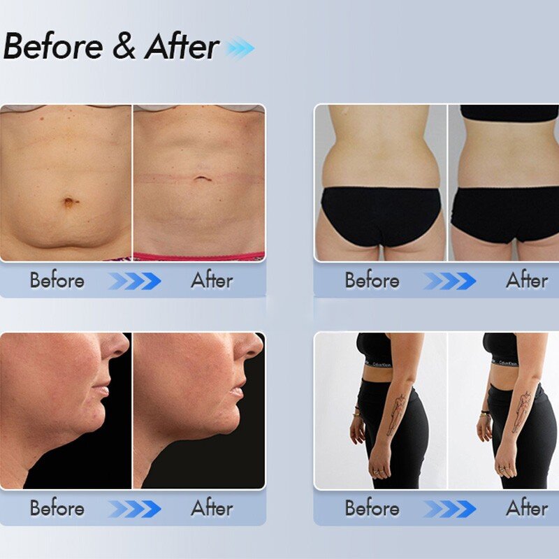 Cool Body Sculpt Machine - Home Use 360 Cryolipolyse Belly Fat Removal US/ZA Plug