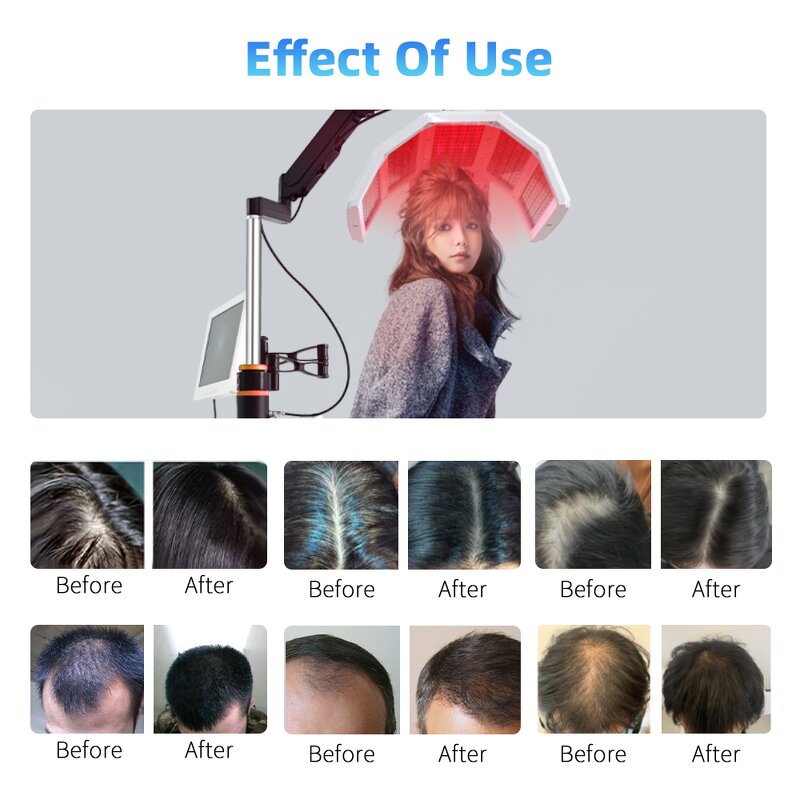 5 In 1 Bio Oxygen Therapy Comb - Scalp Care Hair Regrowth Machine for Stress Loss