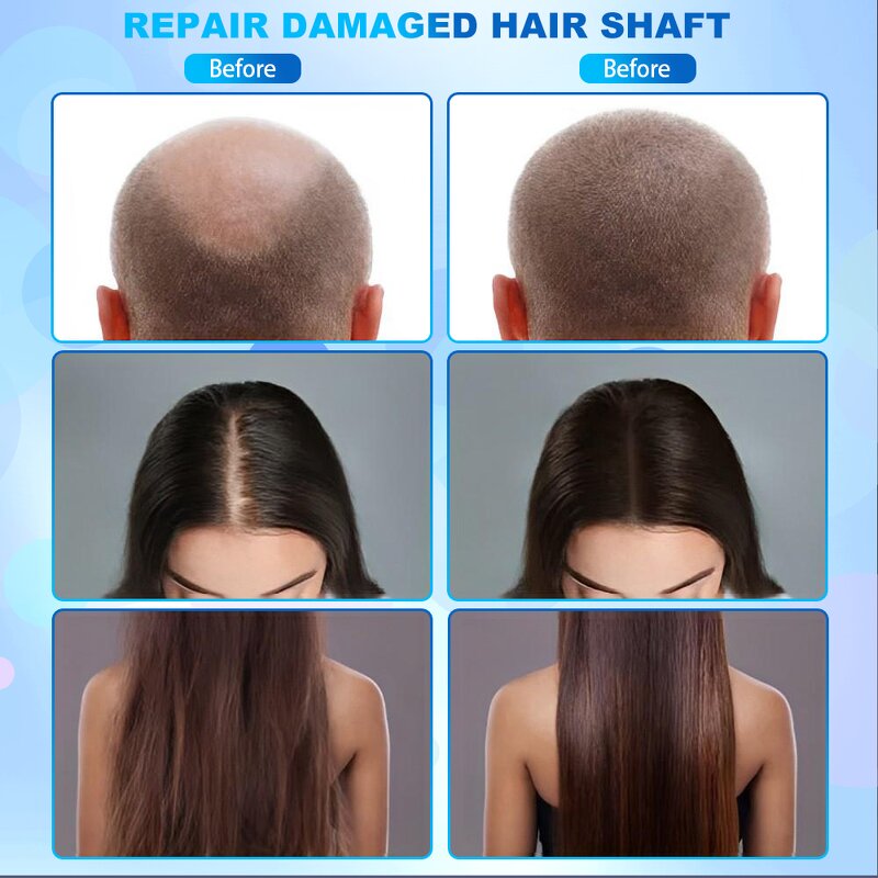 Trichoscopy Camera Hair Analyzer - Desktop LED Light Scalp Therapy Mist Loss Treatment