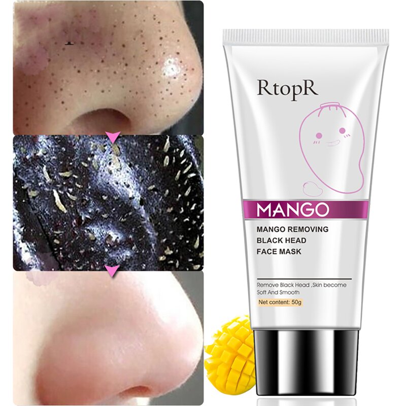 Blackhead Remover Mask Manufacturer - Mango Mud Acne Treatment Peel Off Nose
