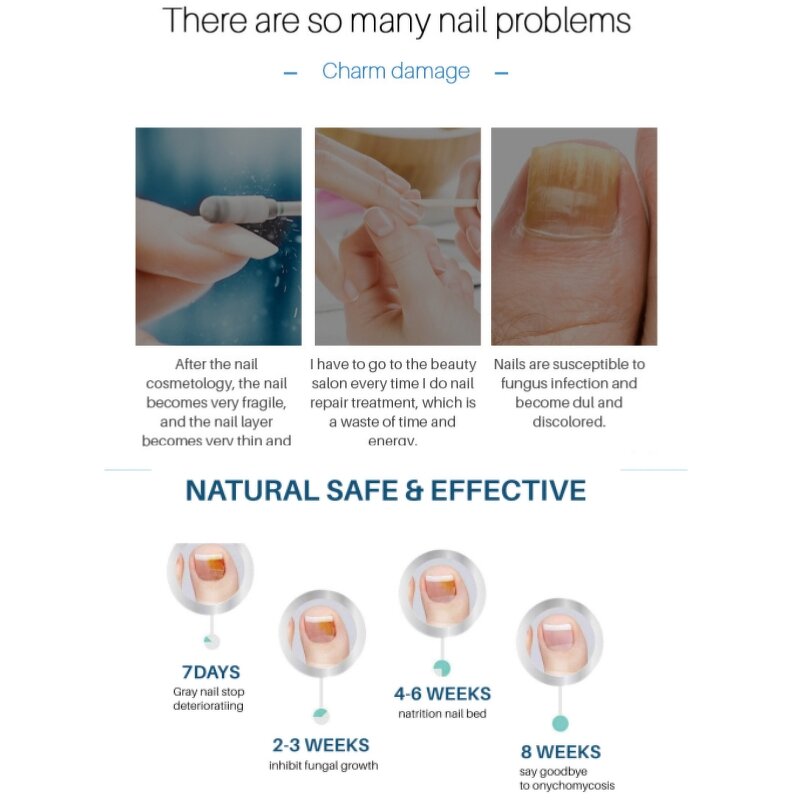 Nail Repair Liquid Manufacturer - Transparent Moisturizing Hand Foot Fungal Treatment