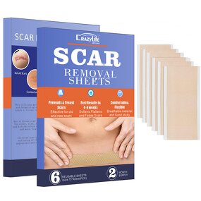 Silicone Scar Removal Patch Manufacturer - Surgical Trauma Burn Acne Treatment