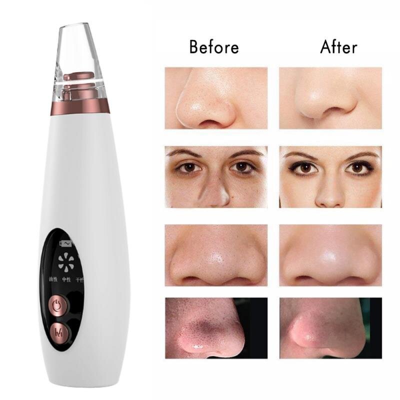 Blackhead Remover Manufacturer - 6 in 1 Electric Vacuum Suction with 6 Suckers