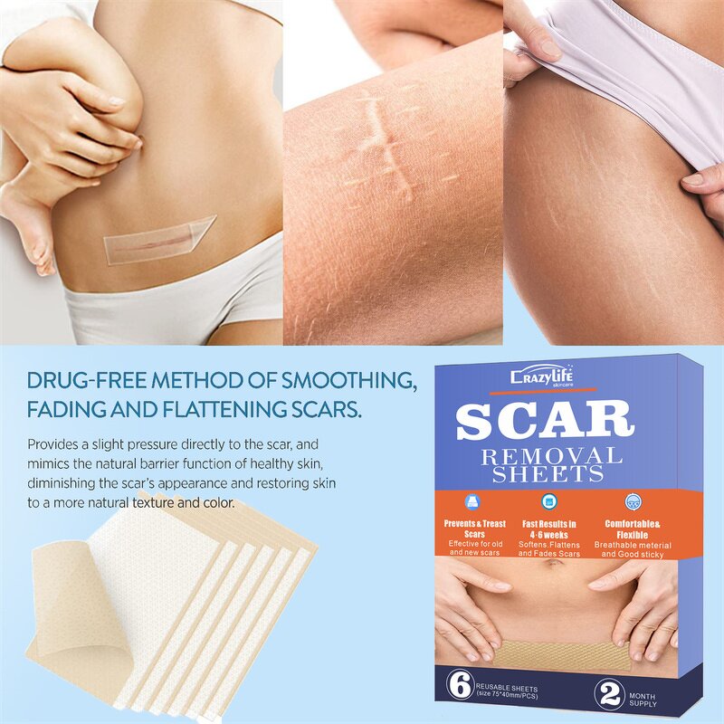 Silicone Scar Removal Patch Manufacturer - Surgical Trauma Burn Acne Treatment
