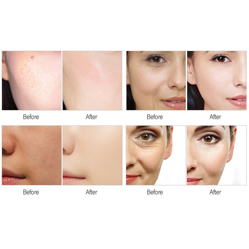 No Needle Mesotherapy - Portable High Pressure Injection Gun Face Moisture Care