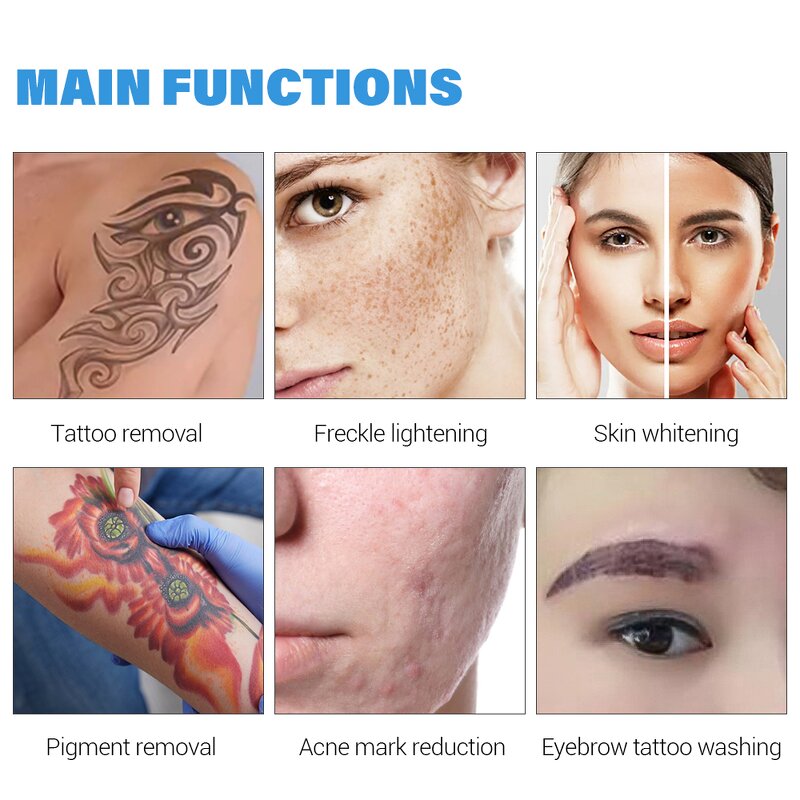 5 in 1 Picosecond Laser Machine - Portable Blackhead Tattoo Removal 7 Languages Non-invasive