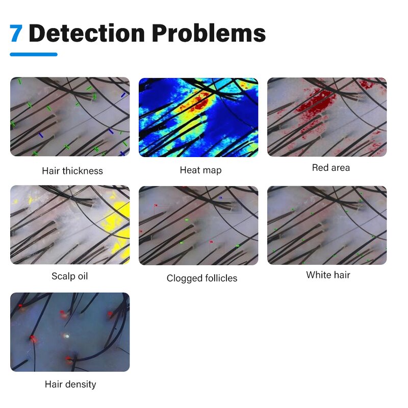 AI Scalp Analyzer - New Tech Portable 3 Spectra Adjustable Screen Hair Device