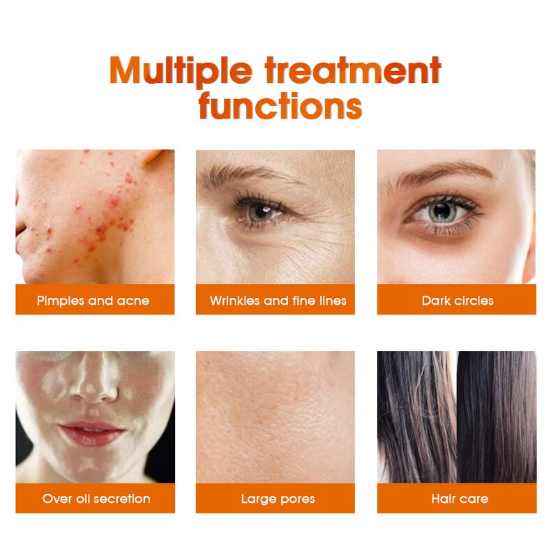 High Frequency Facial Wand - Portable Massager Beauty Wand for Skin Care