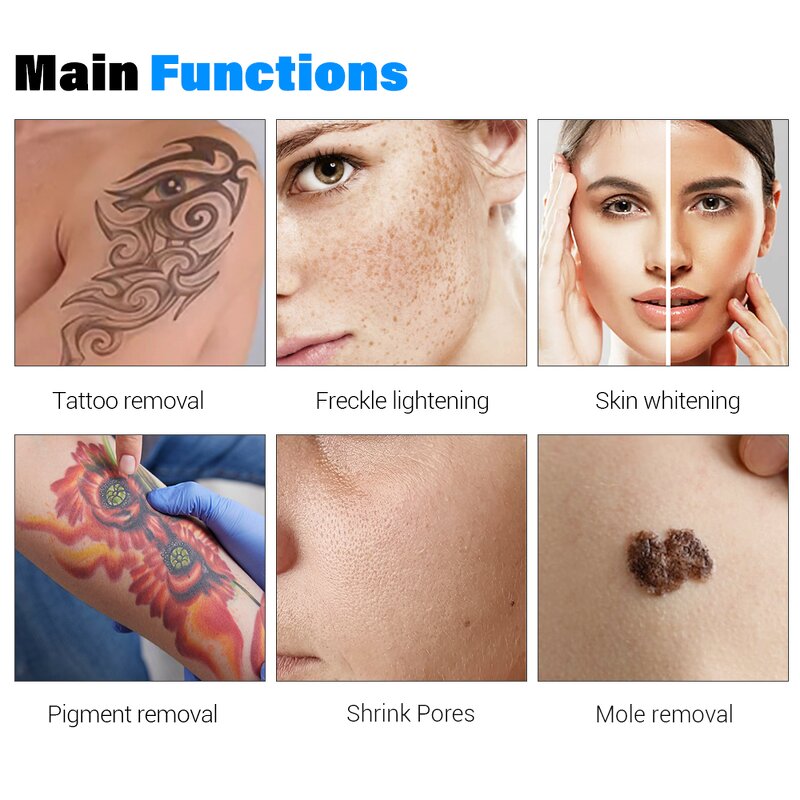 Picosecond Laser Machine - New Portable Blackhead Remover with 8 Languages