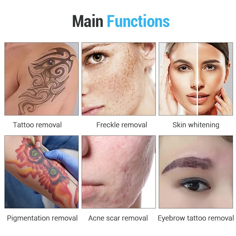 Picosecond Laser Machine - 2024 New Pro Narrow Pulse Carbon Peeling Pigmentation