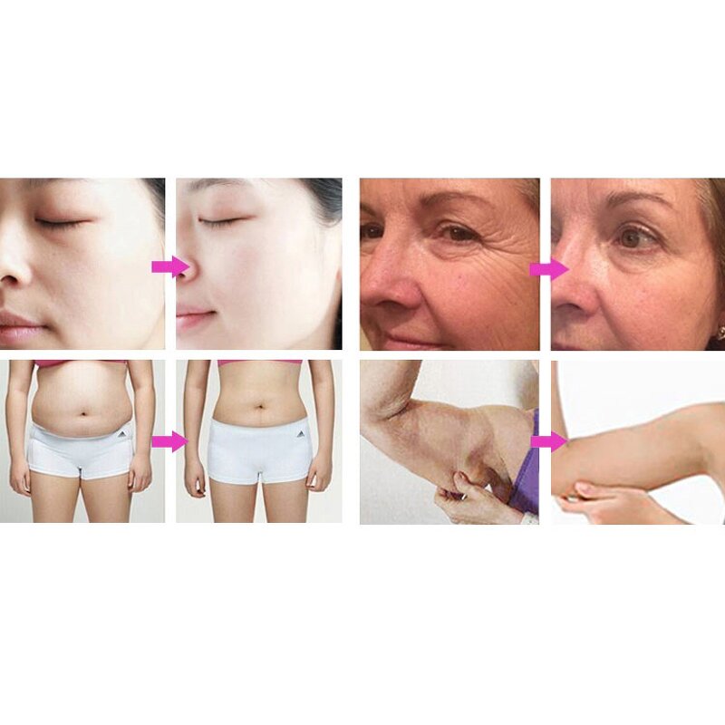 4 in 1 Slimming Machine - Ultrasonic Cavitation RF Vacuum Body Shaping Device